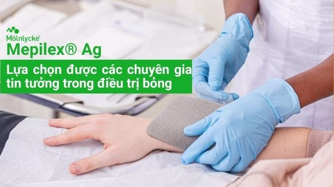 Mepilex® Ag - lựa chọn được các chuyên gia tin tưởng trong điều trị bỏng