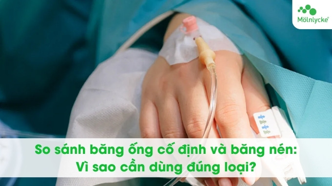 So sánh băng ống cố định và băng nén vì sao cần dùng đúng loại